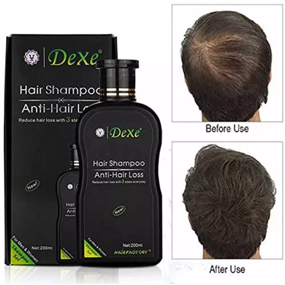 DEXE 200ML HAIR SHAMPOO, ANTI-HAIR LOSS HERBAL HAIR GROWTH, PREVENT HAIR TREATMENT FOR MEN Women I1877191548